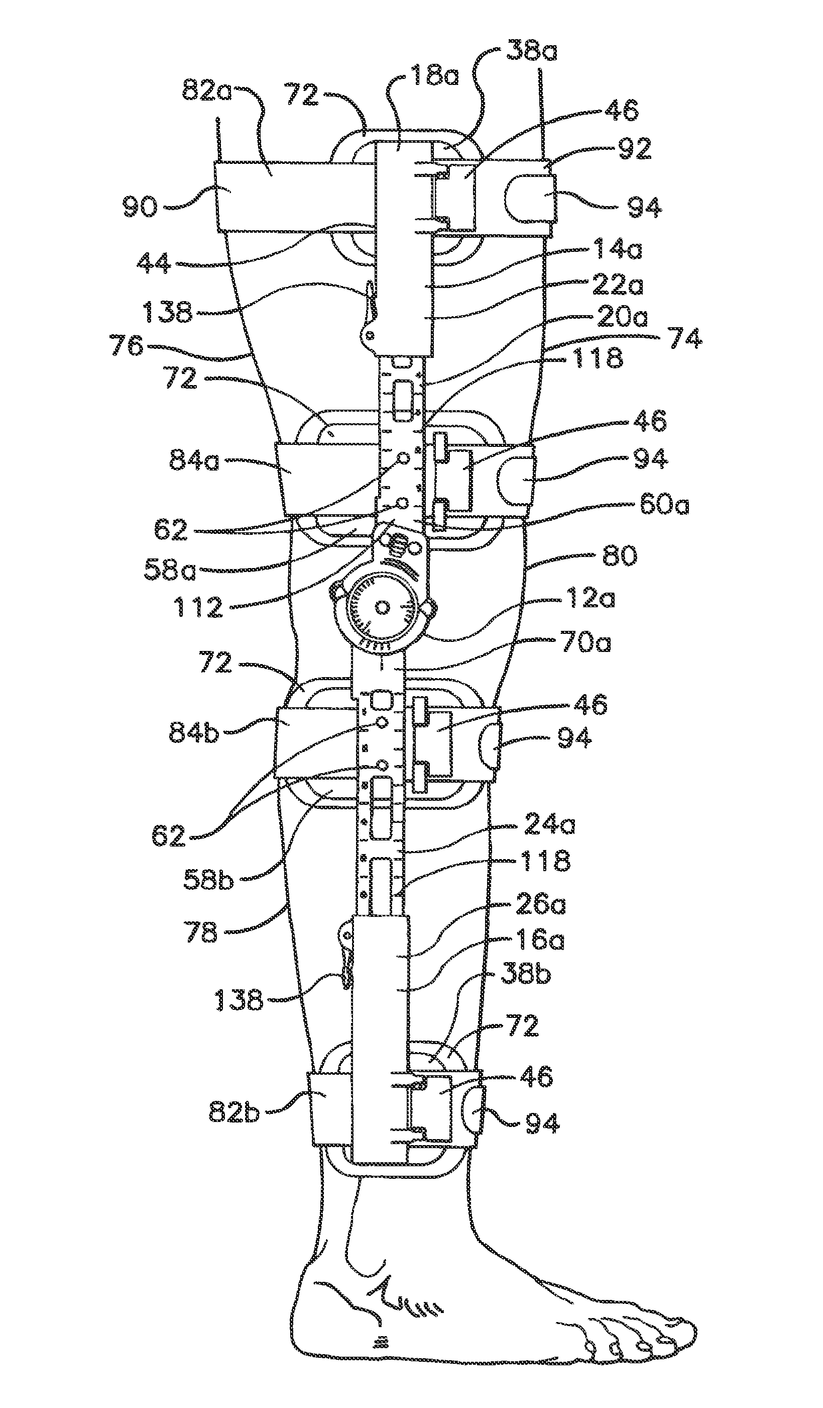 Orthopedic brace having a length-adjusting mechanism and a lockable rotation hinge