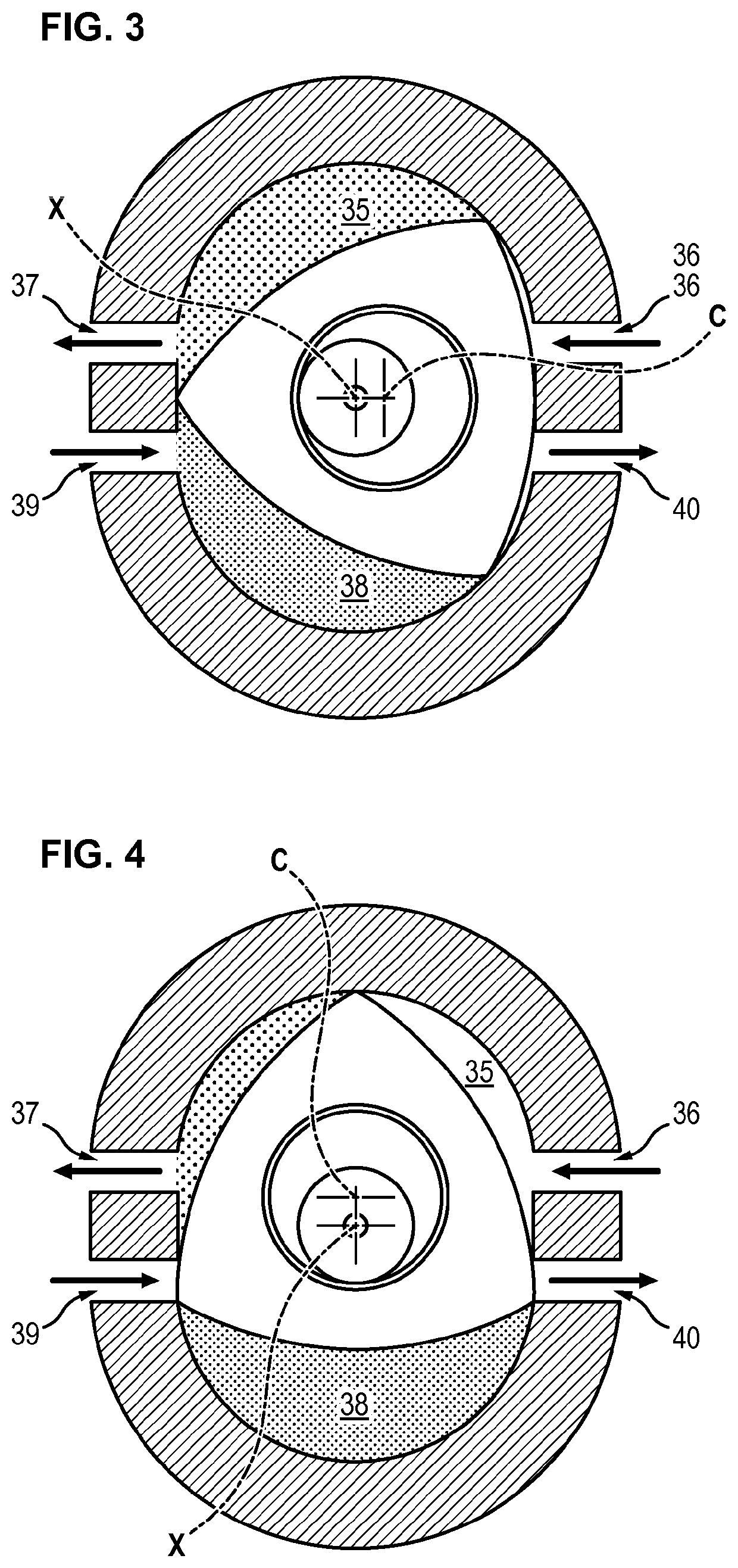 Circulatory assistance system