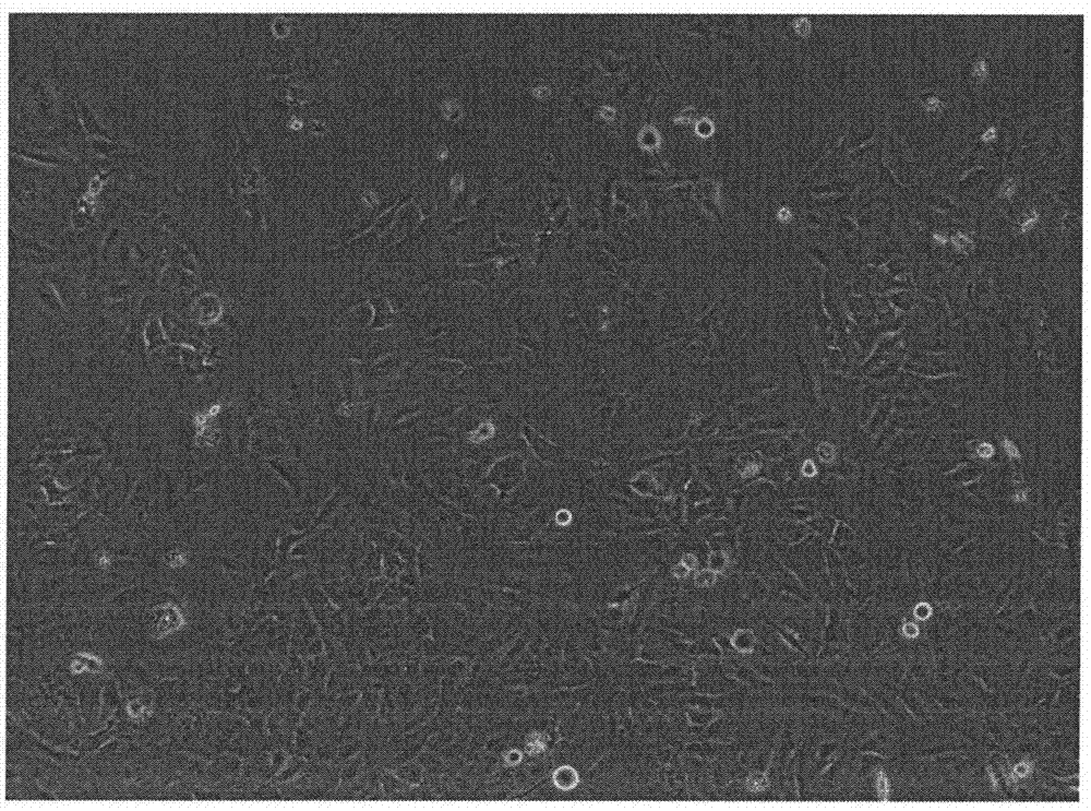 Human hepatoma carcinoma cell line and application thereof