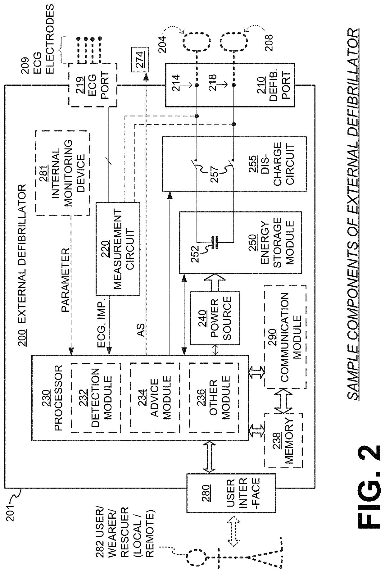 Wearable cardioverter defibrillator (WCD) system detecting QRS complexes in ECG signal by matched difference filter