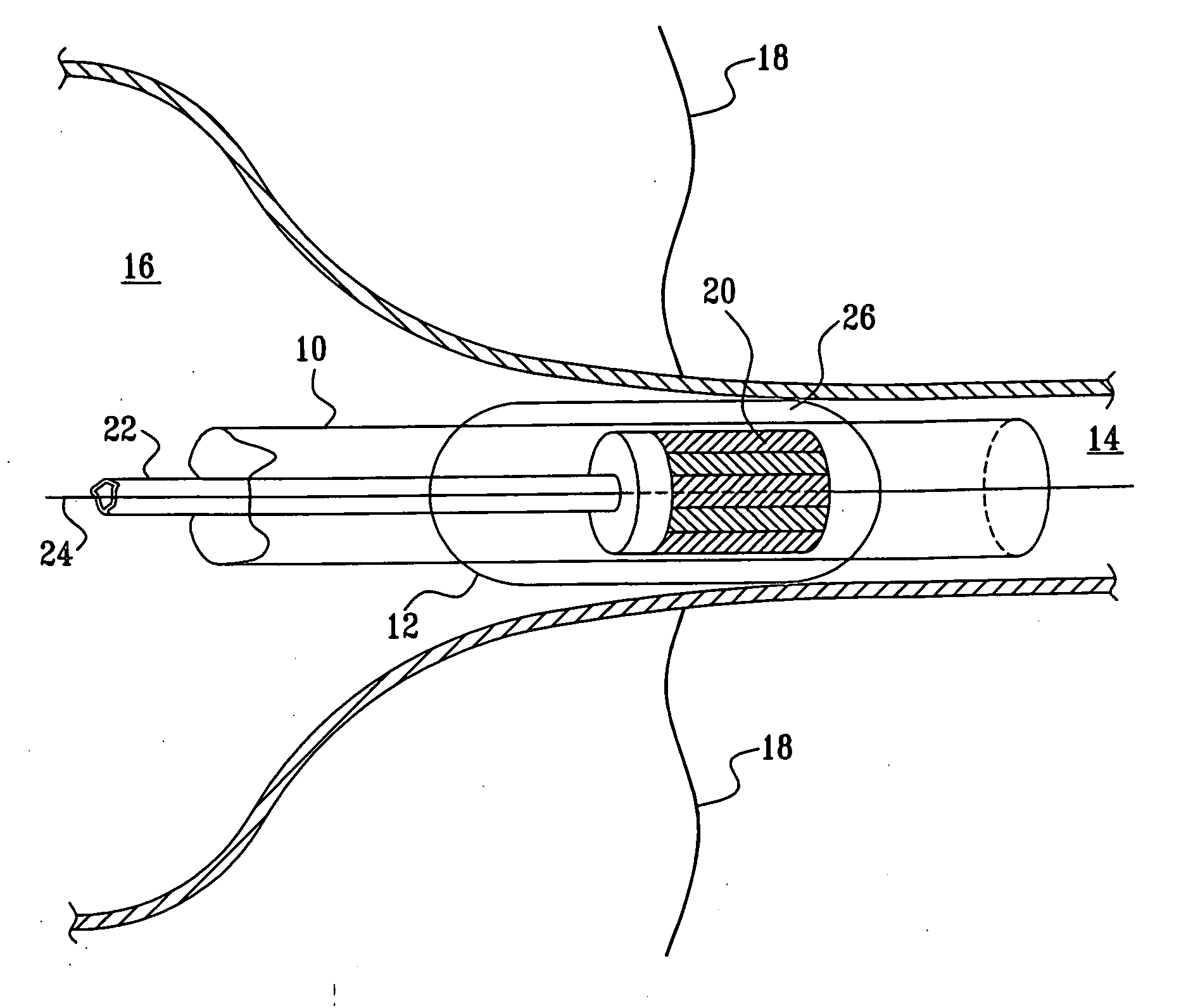 Phased-array for tissue treatment