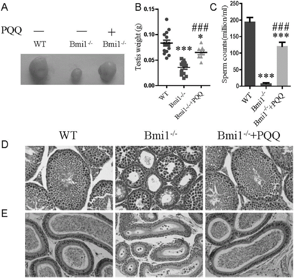 Novel application of pyrroloquinoline quinone in preventing and/or treating male reproductive dysfunction