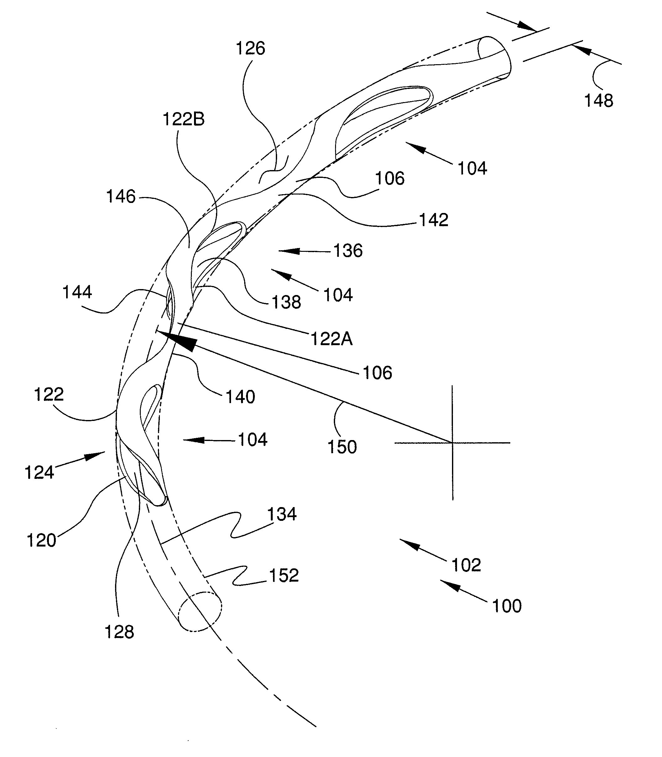 Ocular implants with asymmetric flexibility