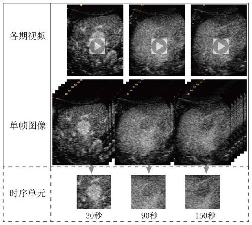 Ultrasound contrast video data analysis method based on composite neural network