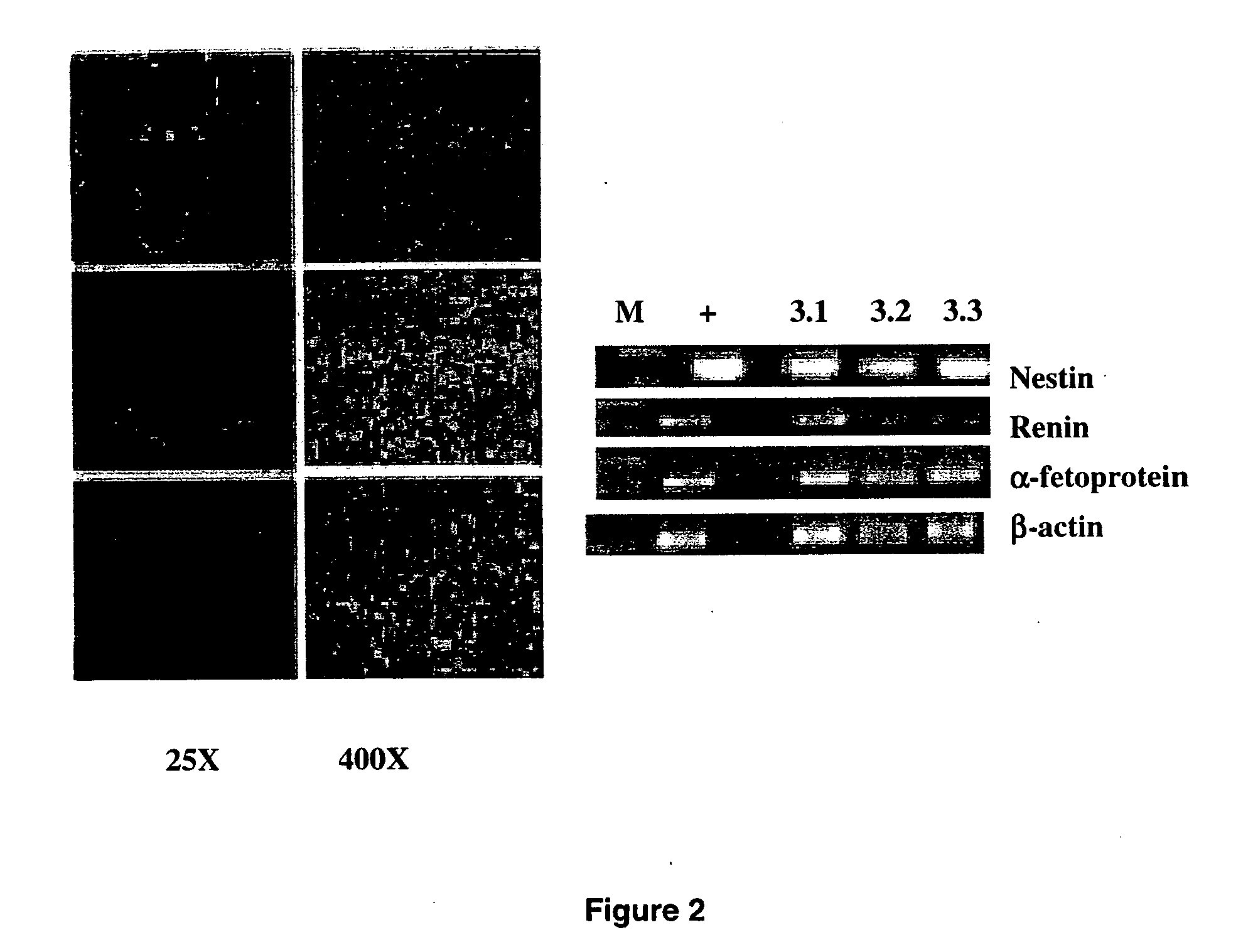 Human embryonic stem cell clones