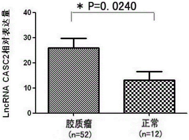 Application method of long-chain non-coding RNA CASC2 derived from serum exosomes