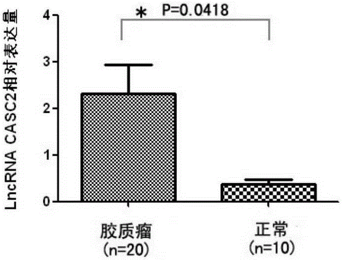 Application method of long-chain non-coding RNA CASC2 derived from serum exosomes