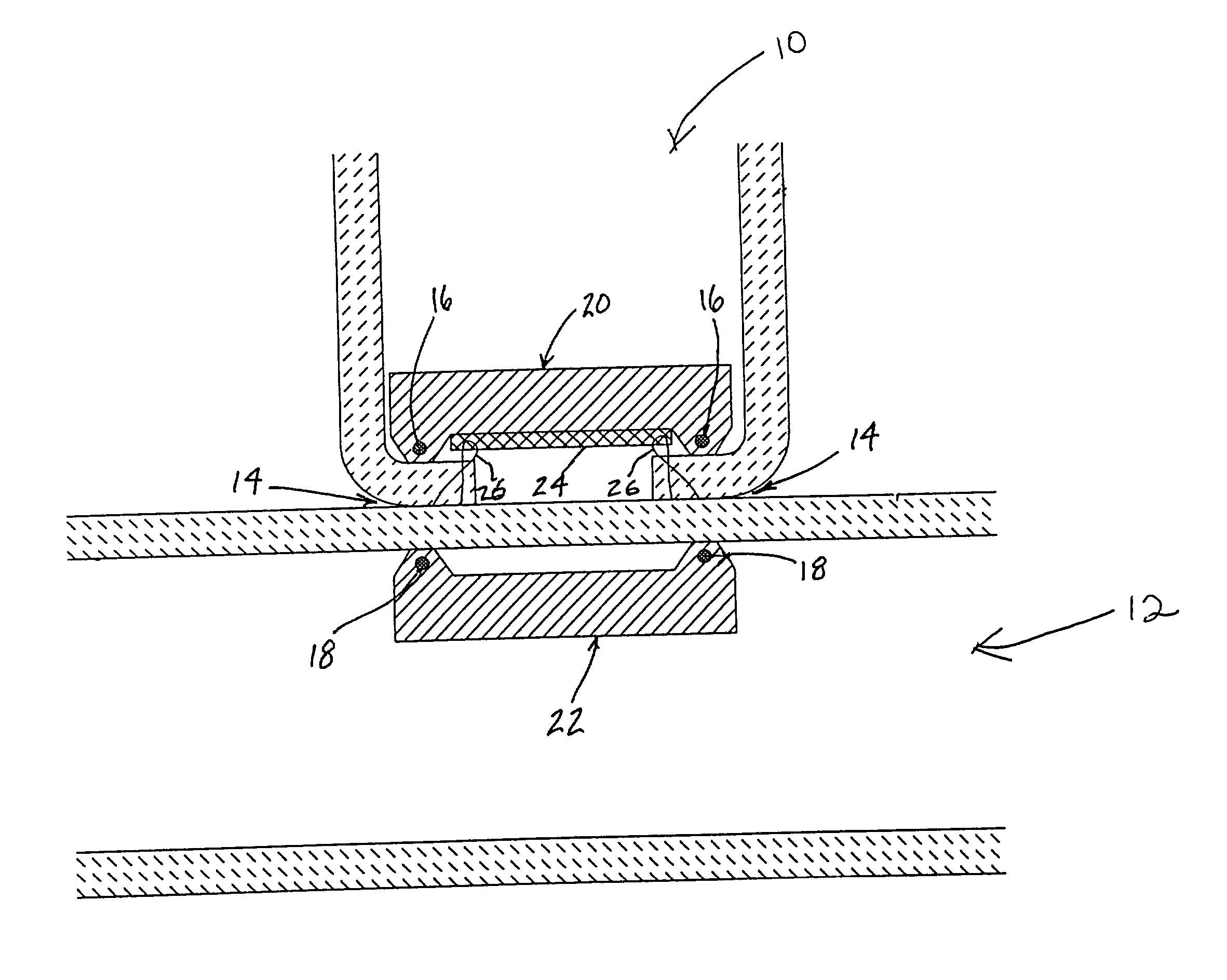 Anastomosis system and related Methods