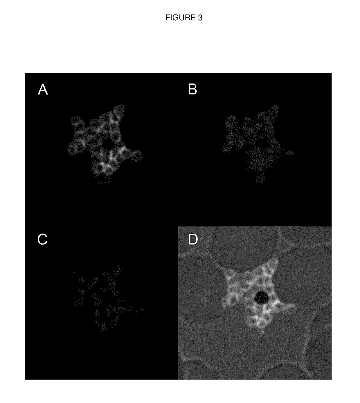 Anti-plasmodium parasite antibodies