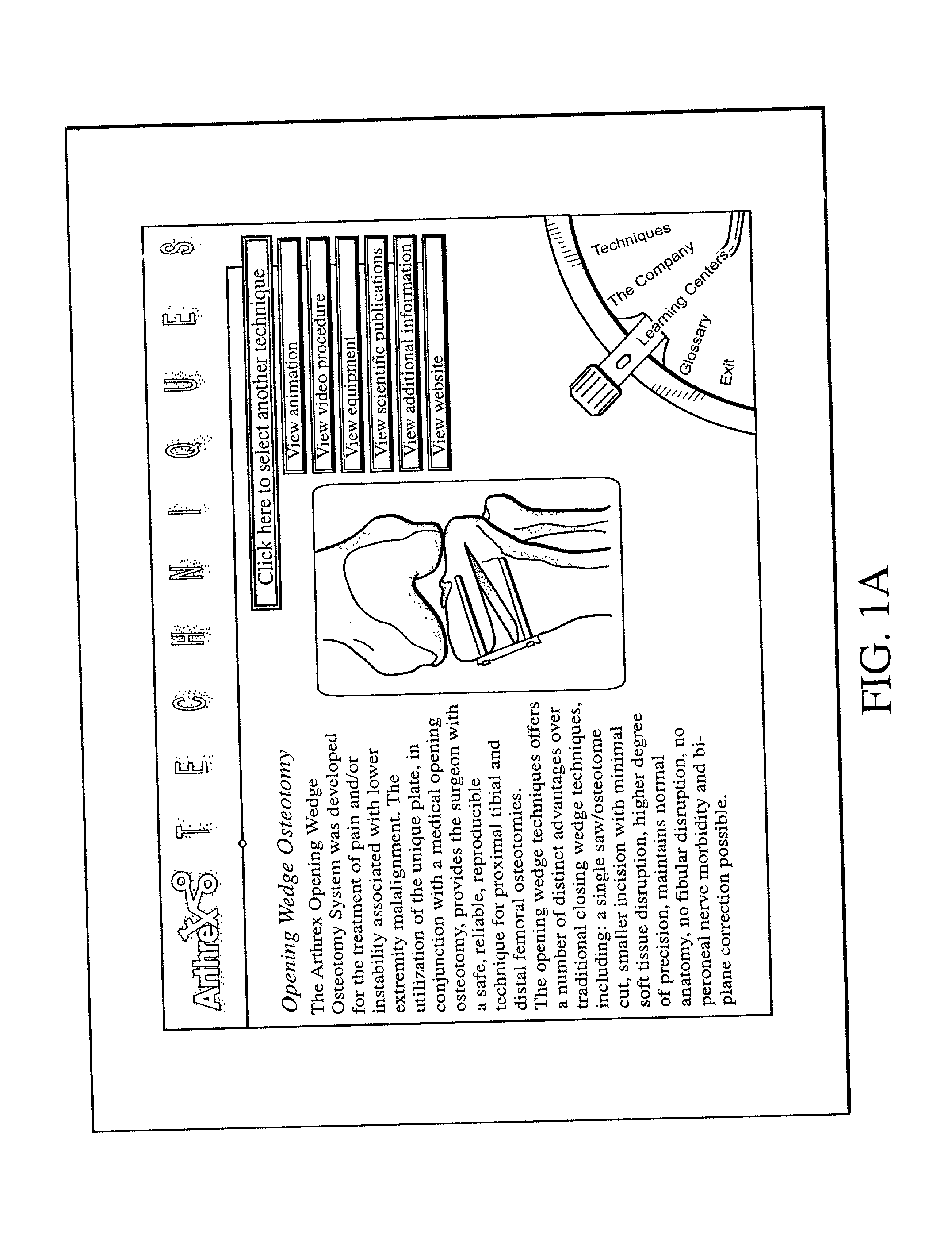 Interactive template for animated surgical technique CD-ROM