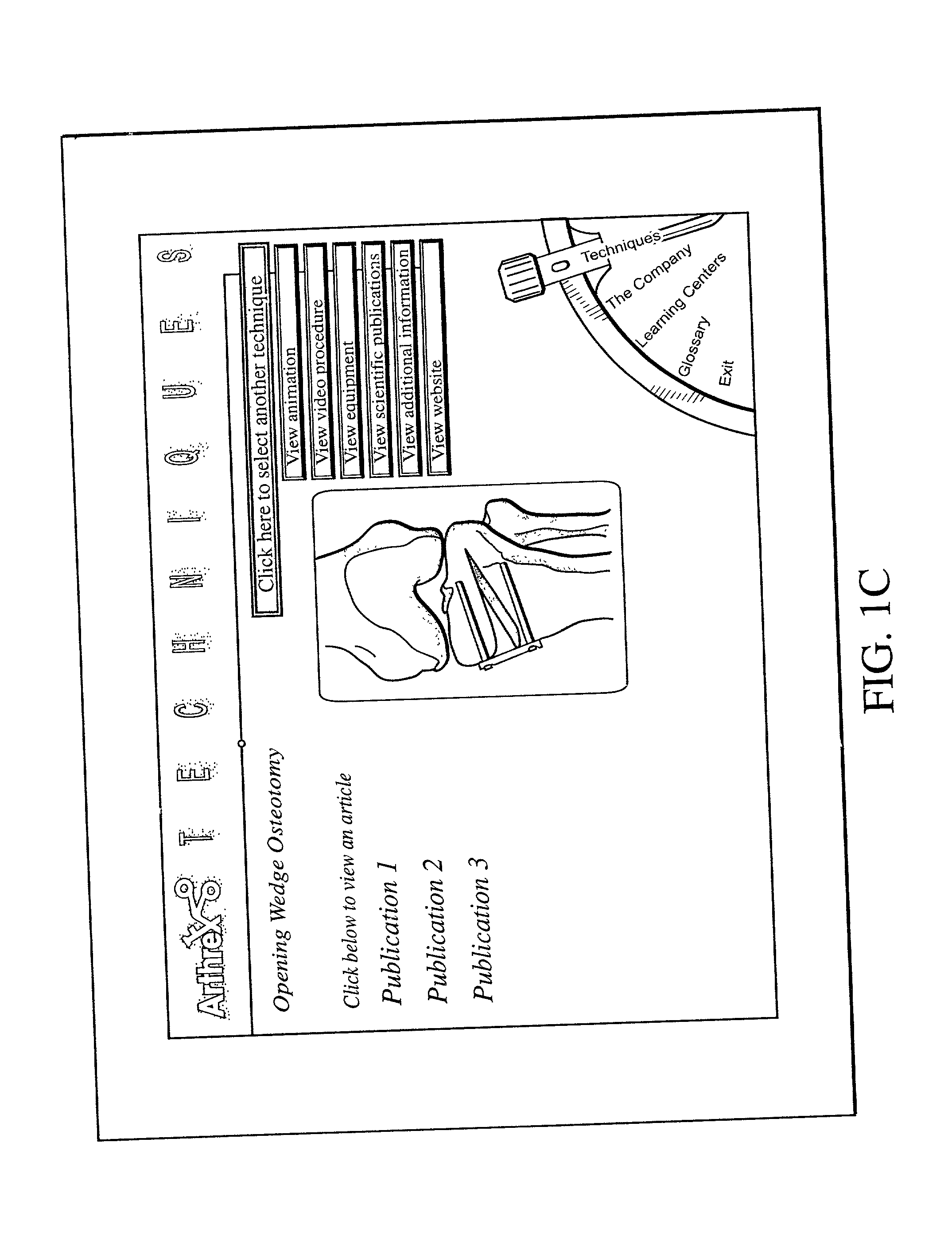 Interactive template for animated surgical technique CD-ROM