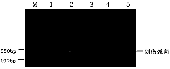 Multiplex-polymerase chain reaction (PCR) detection method capable of simultaneously detecting vibrio parahaemolyticus, vibrio vulnificus and vibrio alginolyticus