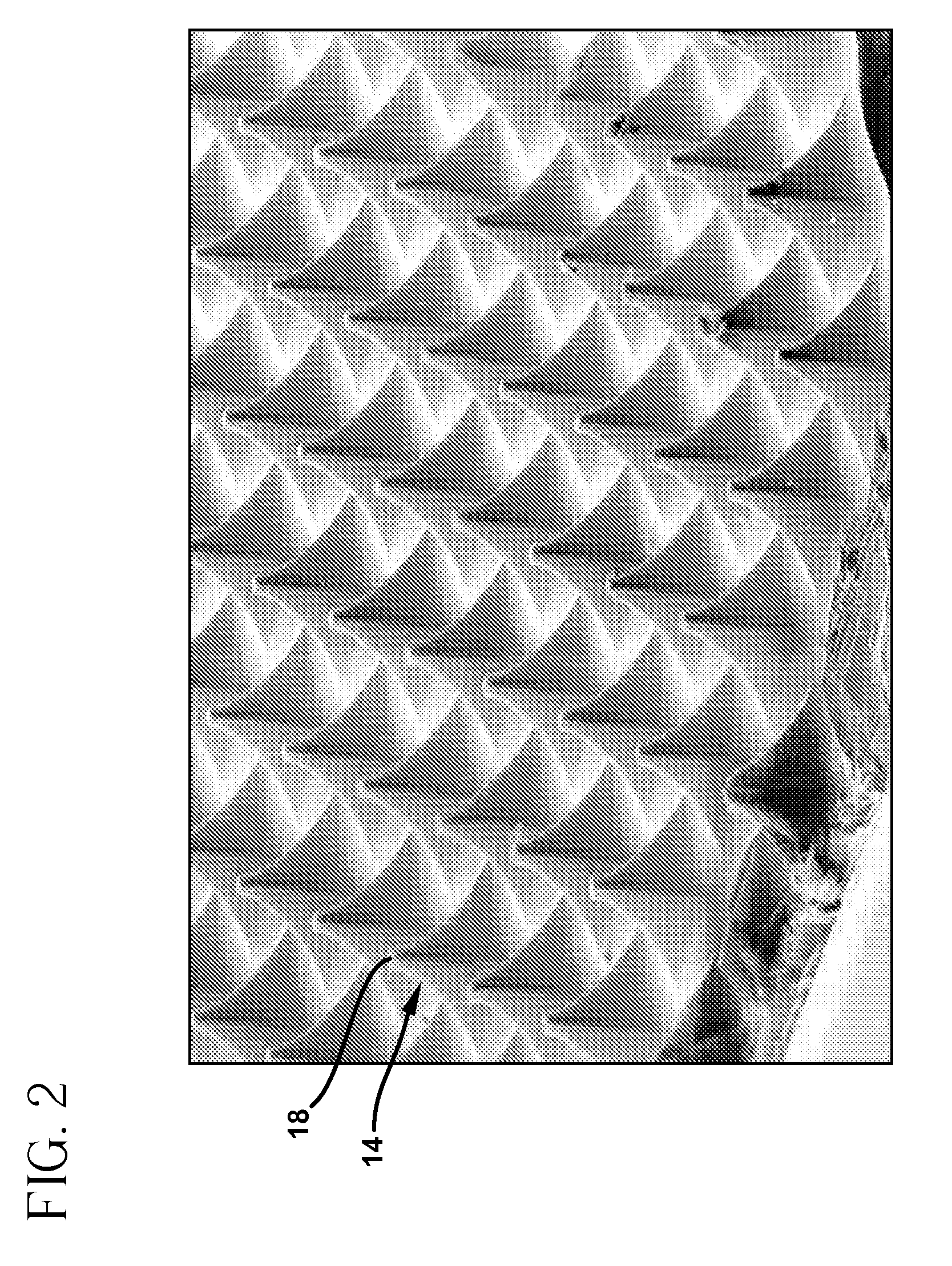 Method and device for abrading skin