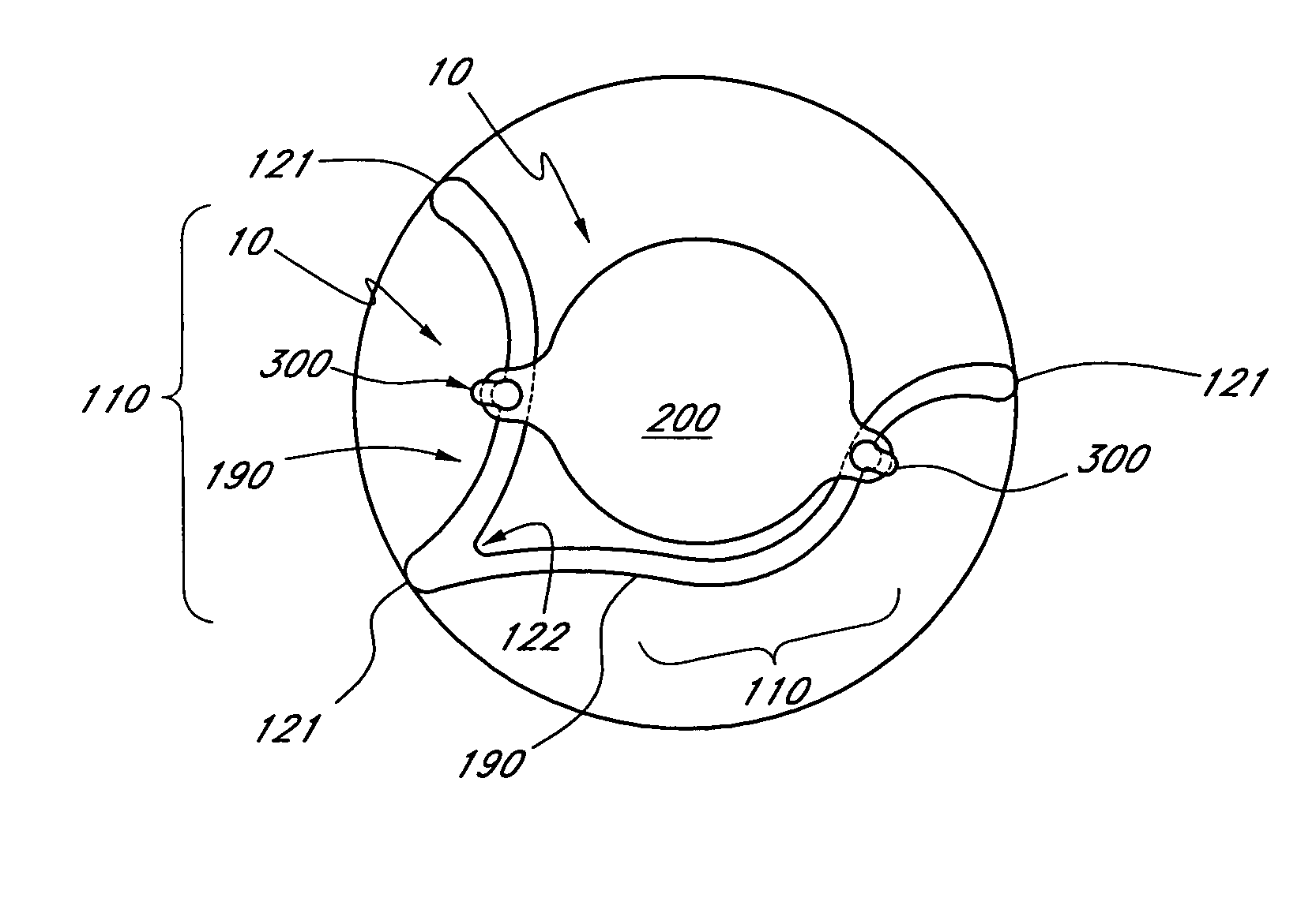 Two part "L"-shaped phakic IOL