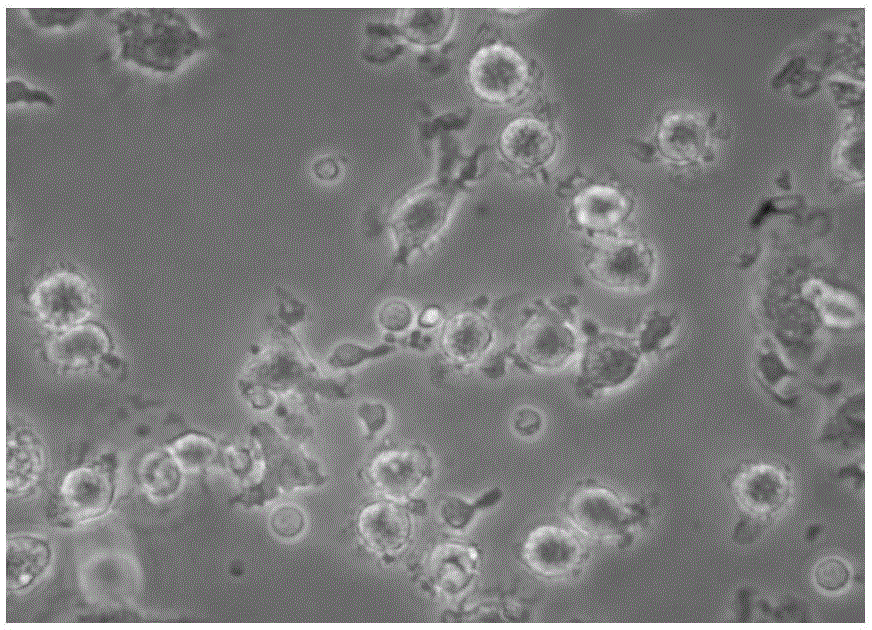 Cultural method for enhancing killing activity and proliferative activity of LAK (lymphokine-activated killer) cells and application