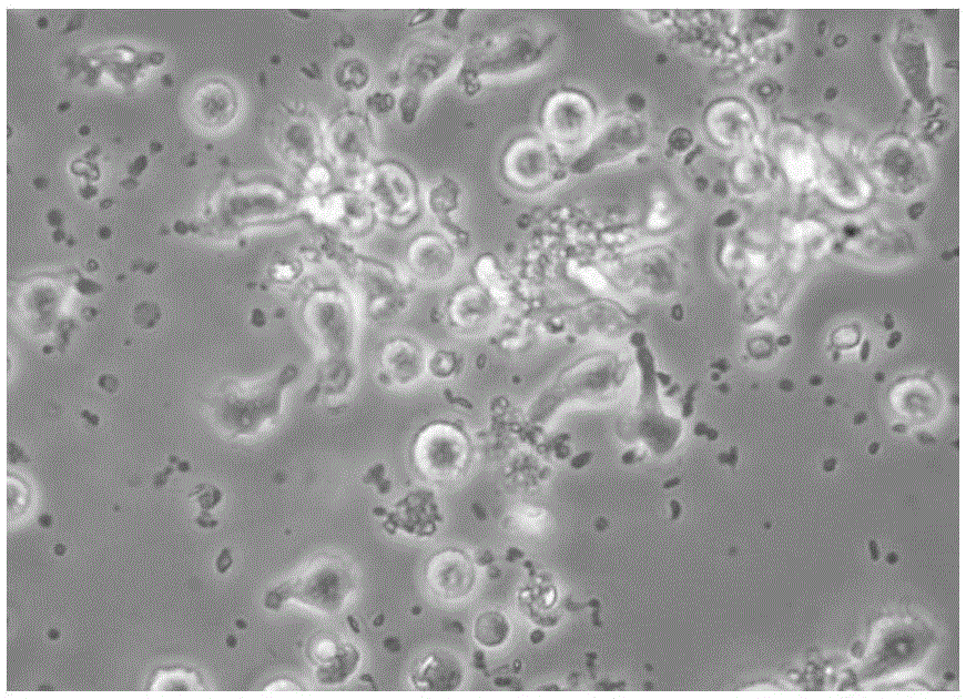 Cultural method for enhancing killing activity and proliferative activity of LAK (lymphokine-activated killer) cells and application