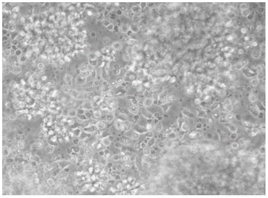 Cultural method for enhancing killing activity and proliferative activity of LAK (lymphokine-activated killer) cells and application