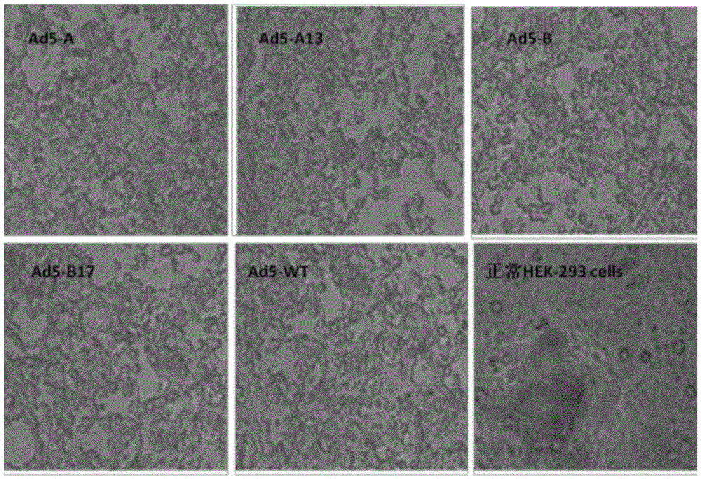 Recombinant adenovirus expressing human enterovirus 71 capsid protein and vaccine prepared from same and application thereof