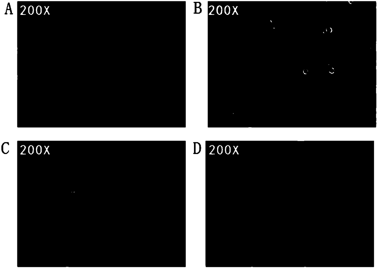 Drug-resistance cell system for lung cancer and preparation method thereof