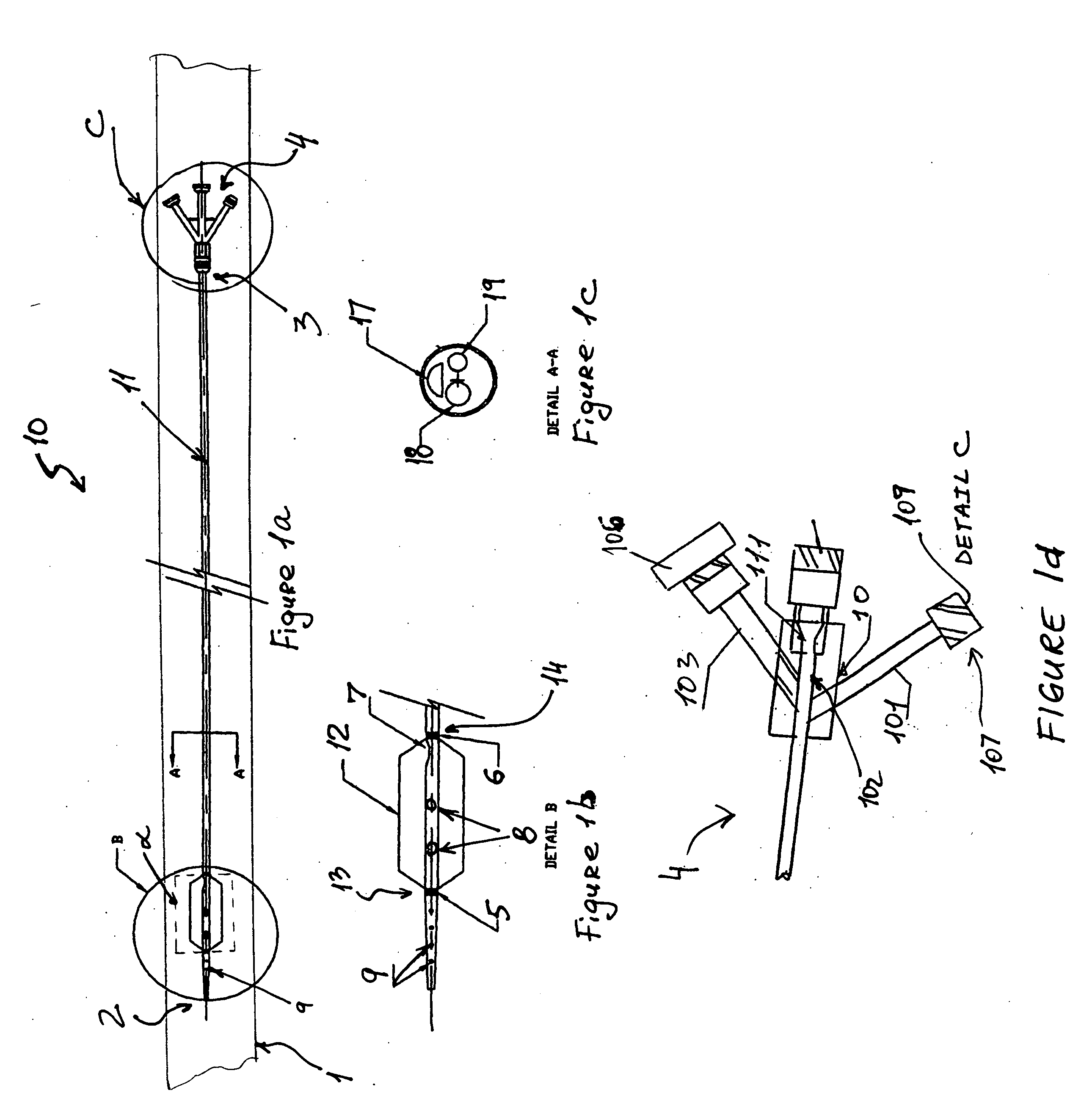 Percutaneously retrievable stent assembly with fluid draining capability