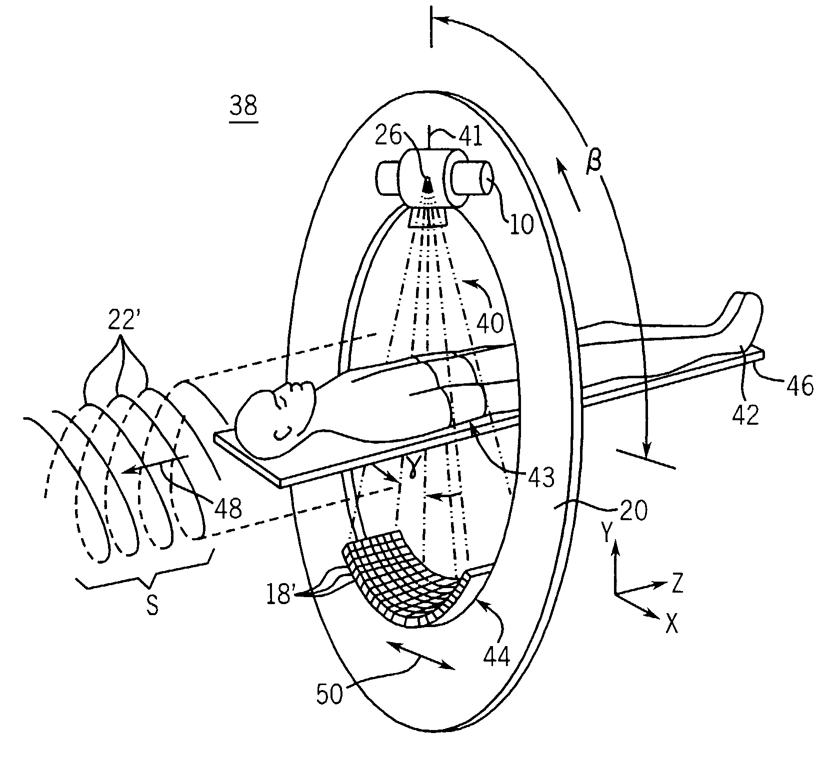 Time resolved computed tomography angiography