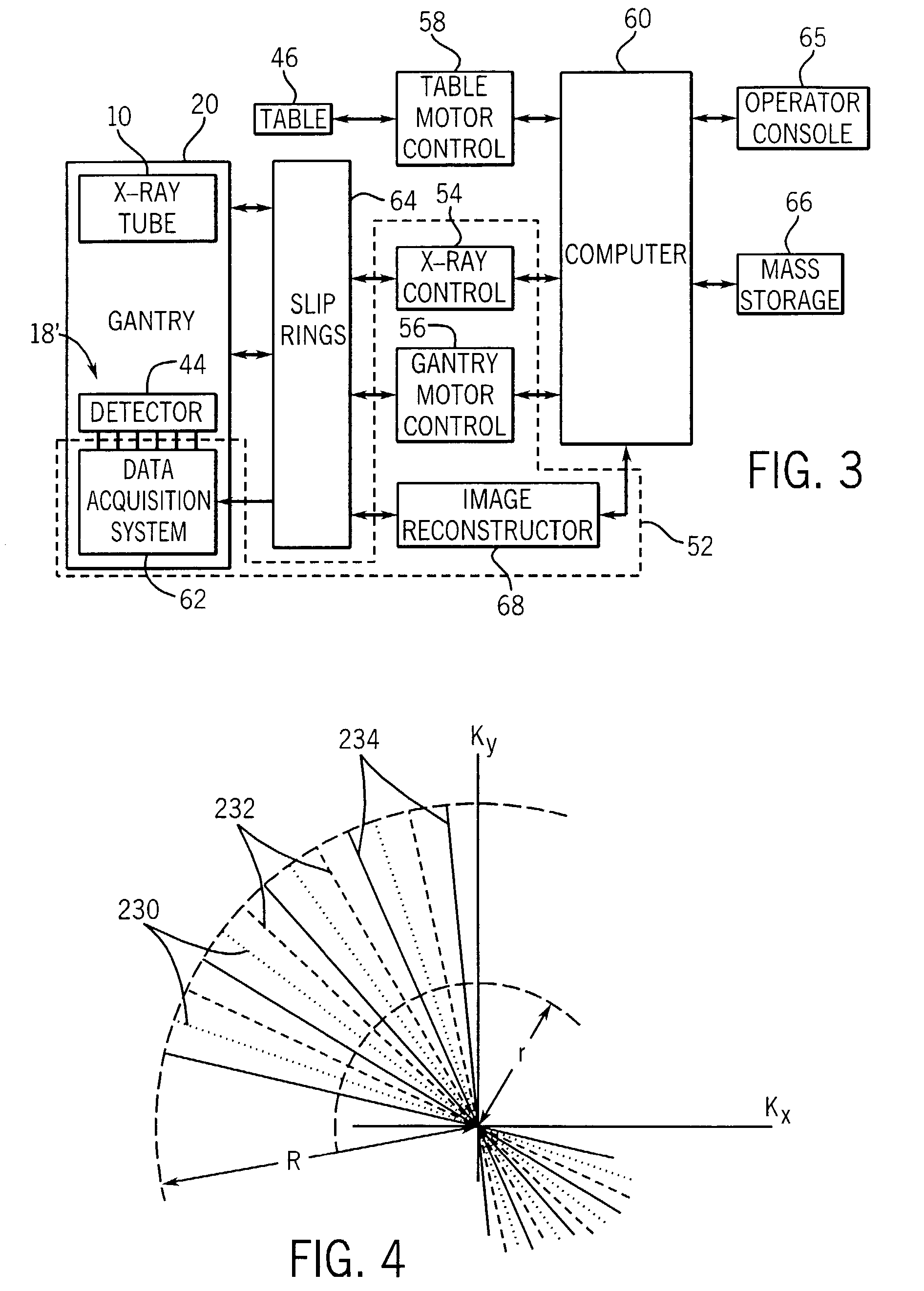 Time resolved computed tomography angiography