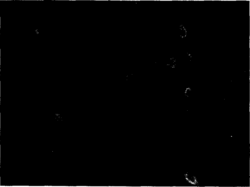 Target directional DNA vaccine for preventing caries and preparation method thereof