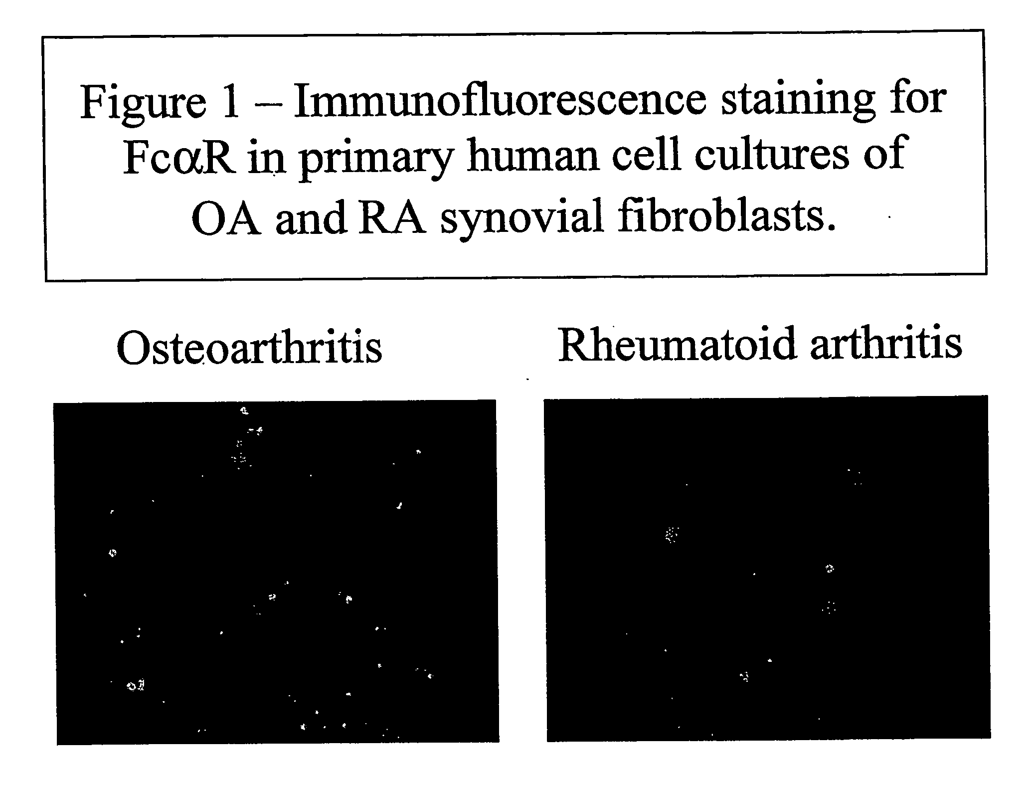 Modulation of mesenchymal cells via iga-receptors