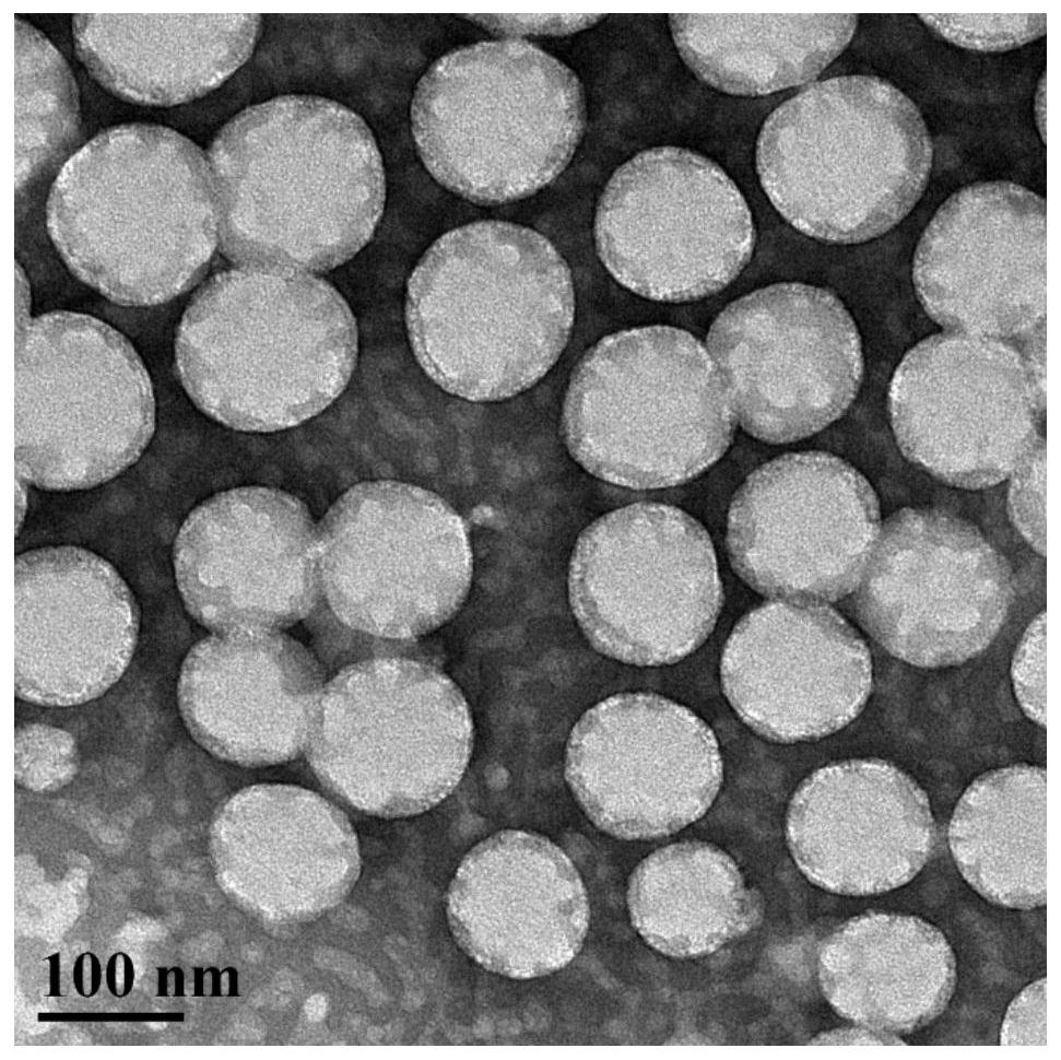 A thermosensitive polymersome and its preparation method and application