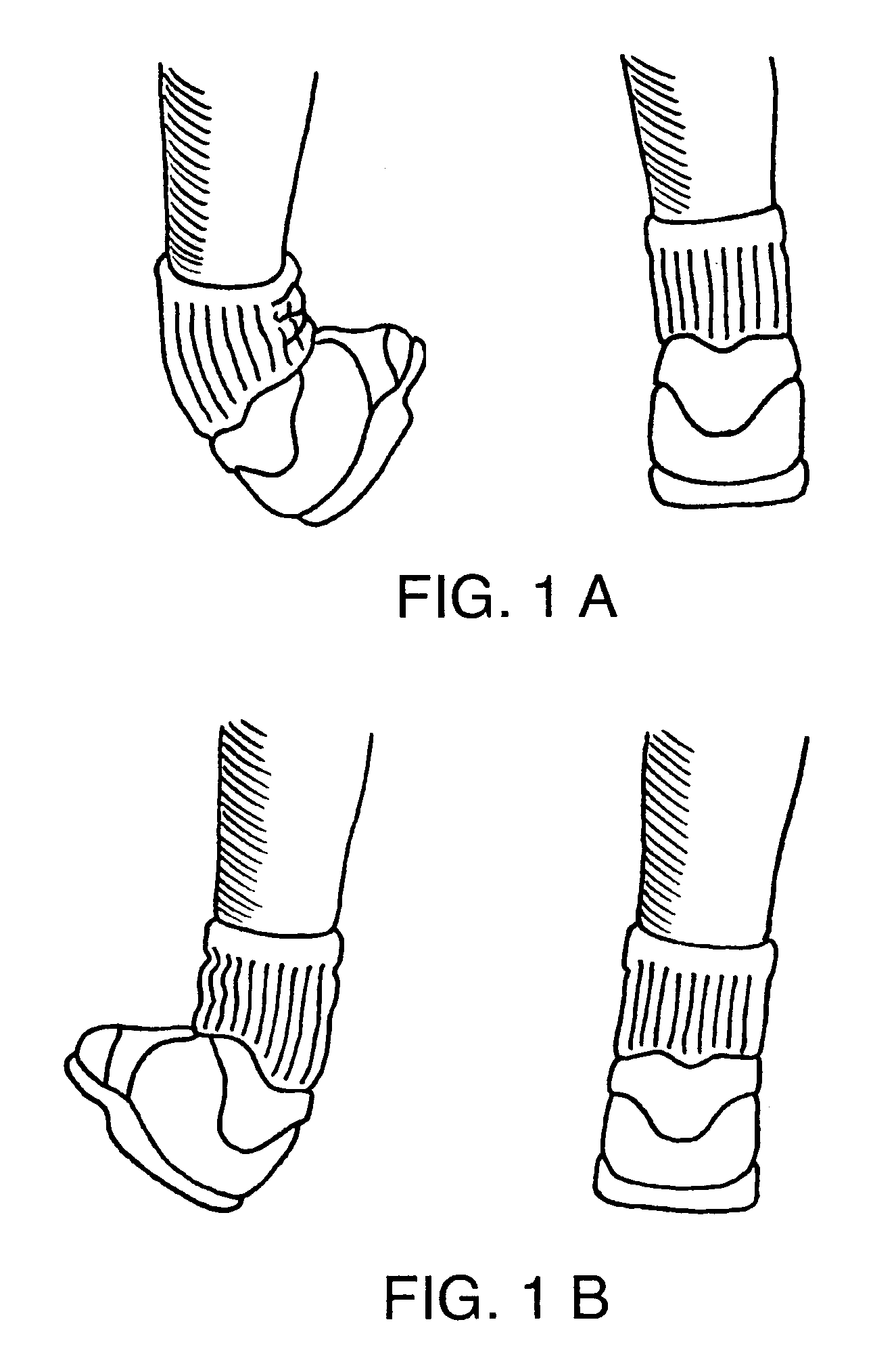 Athletic footwear and the like with integral supinator device