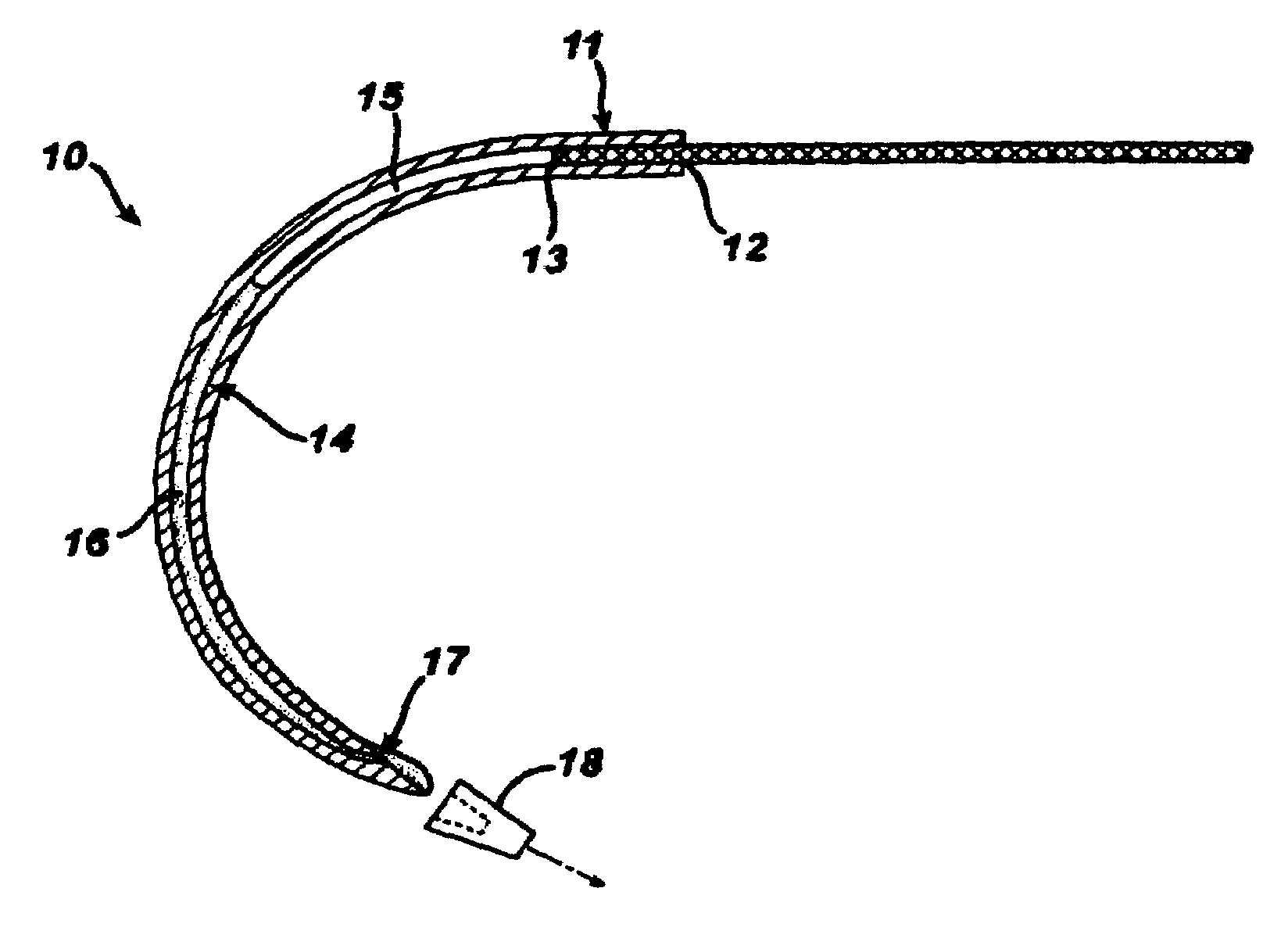 Fluid emitting suture needle