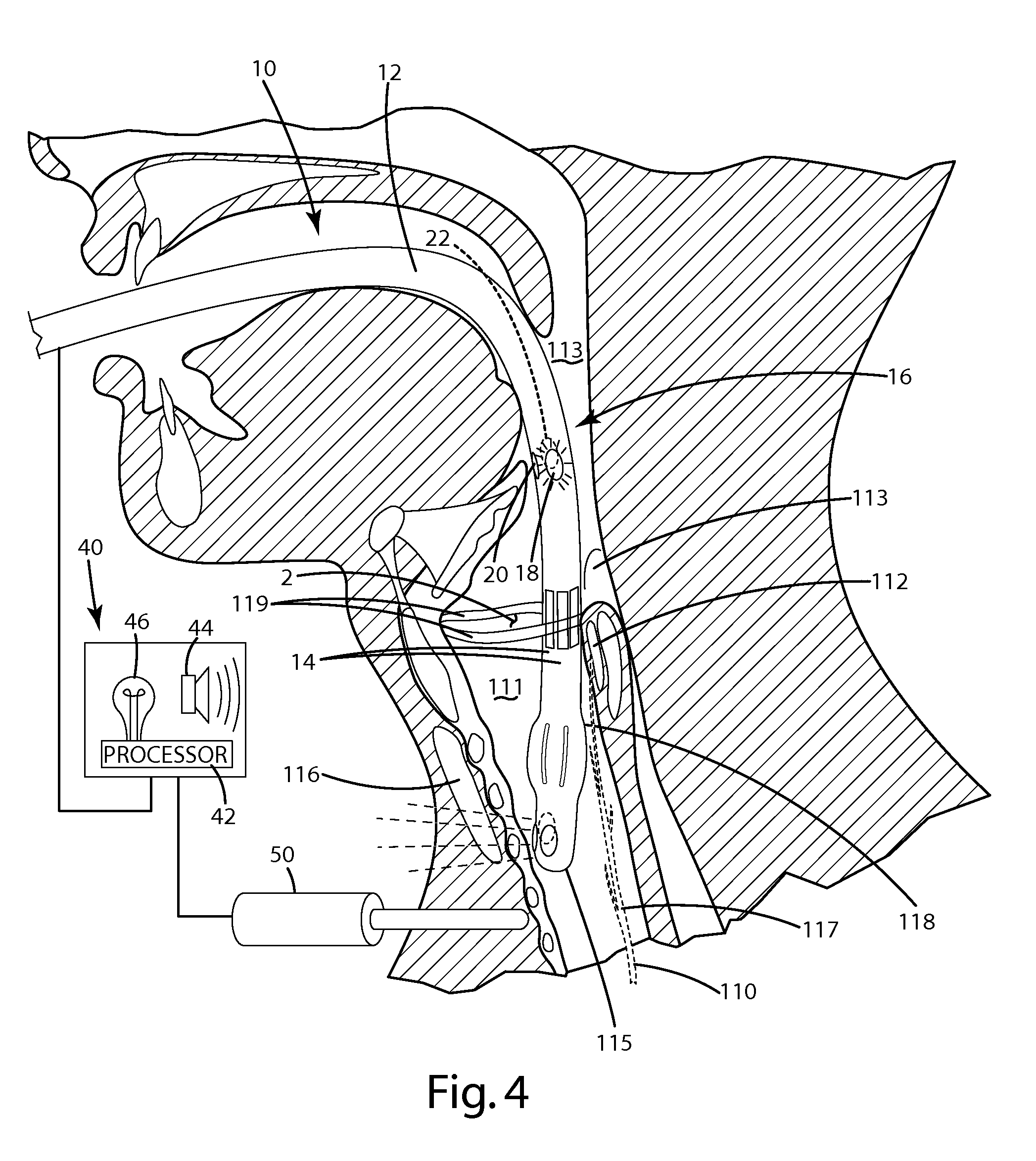 Nerve monitoring device