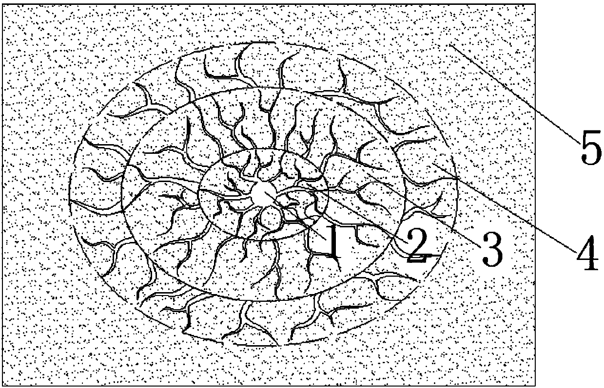 Soft coal step-by-step zooming hydraulic fracturing anatonosis device and method