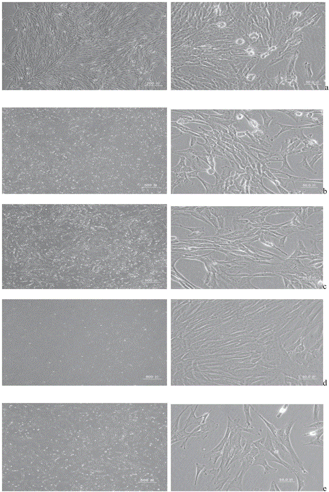 In-vitro separation and cultivation method for tooth-sourced mesenchymal stem cells