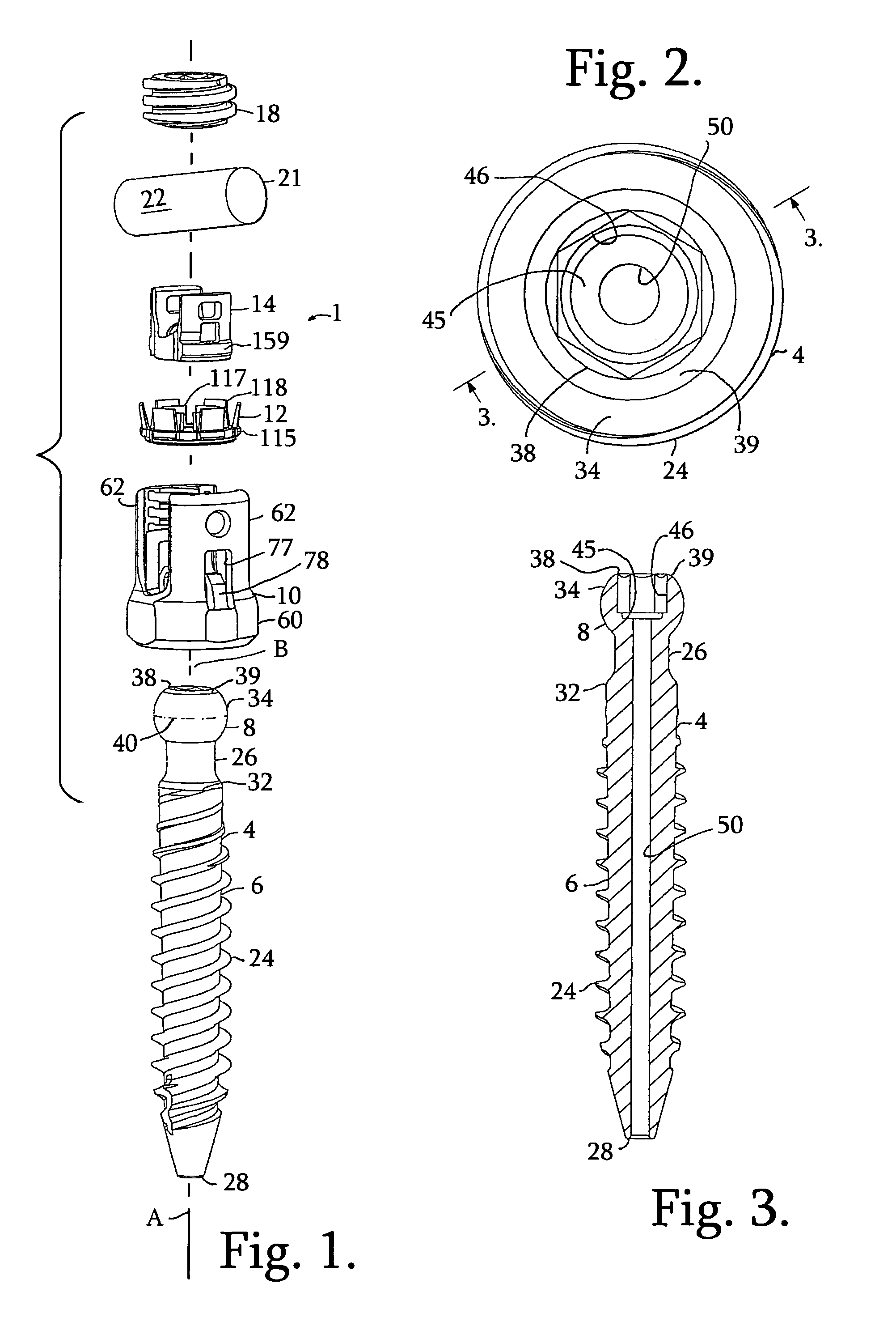 Connecting member with tensioned cord, low profile rigid sleeve and spacer with torsion control