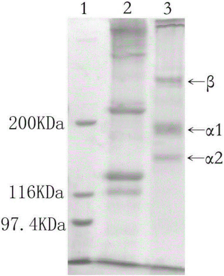 Undenatured collagen based biosurfactant with ionic liquid as reaction medium and preparation method thereof