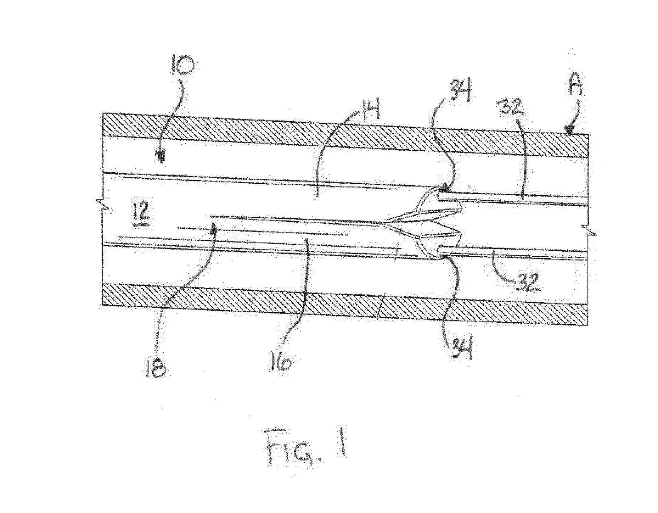 Septotomy Catheter For Aortic Dissection