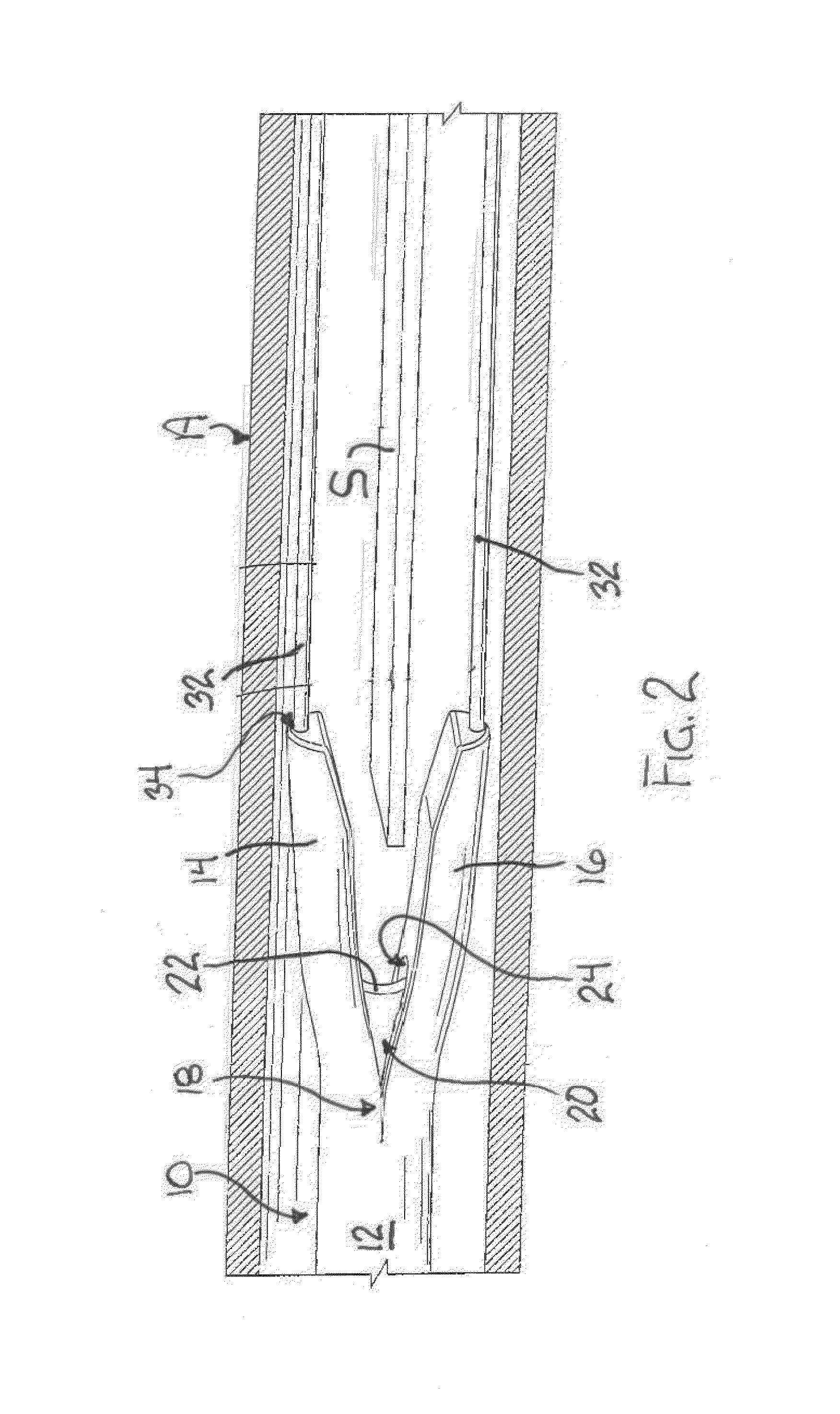 Septotomy Catheter For Aortic Dissection