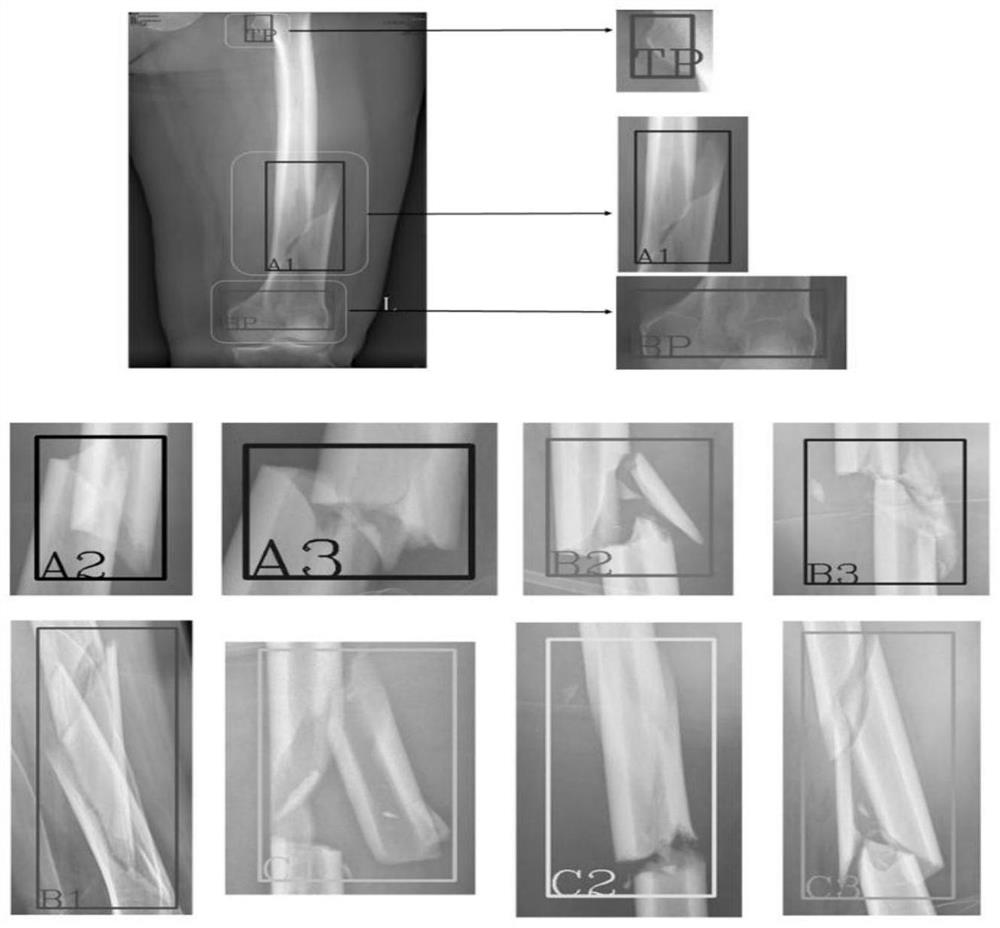 Fracture type classification method and fracture identification model construction method