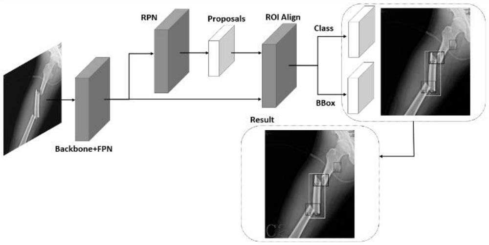 Fracture type classification method and fracture identification model construction method