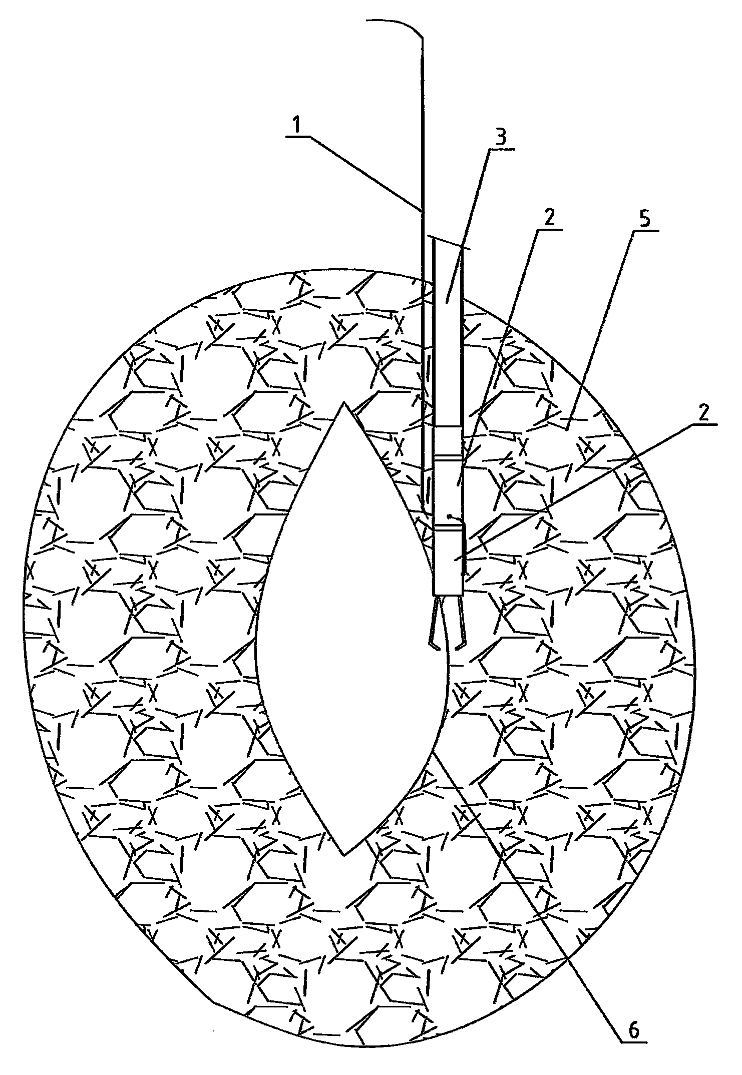 Rapid tissue perforation suture instrument