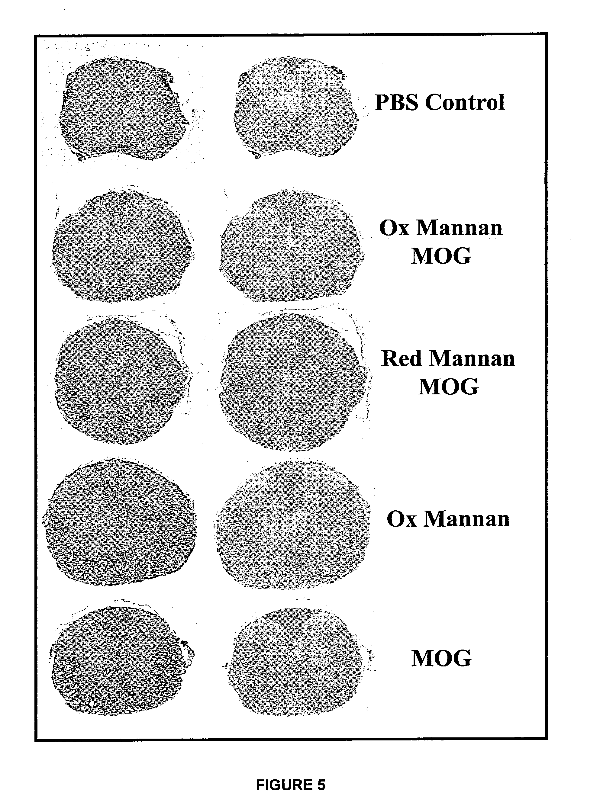 Therapeutic myelin sheath derived antagonist peptide conjugates