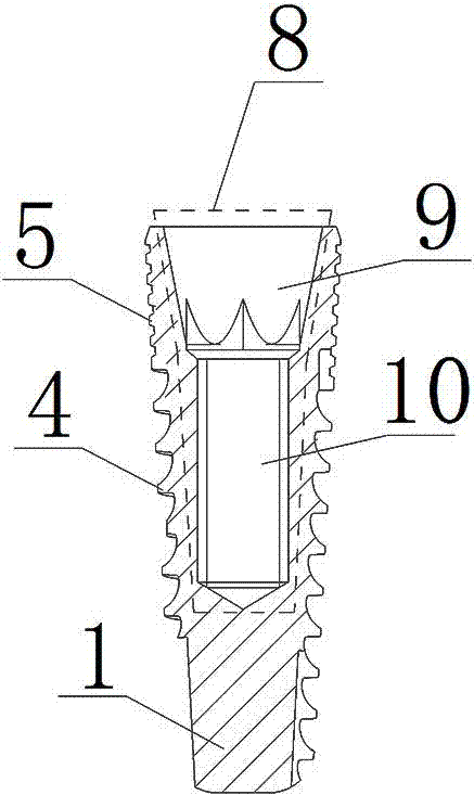 A new dental implant system