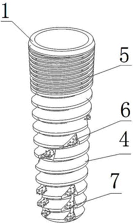 A new dental implant system