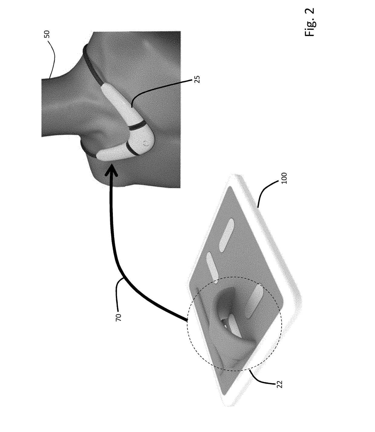 Combined floormat and body-worn physiological sensors