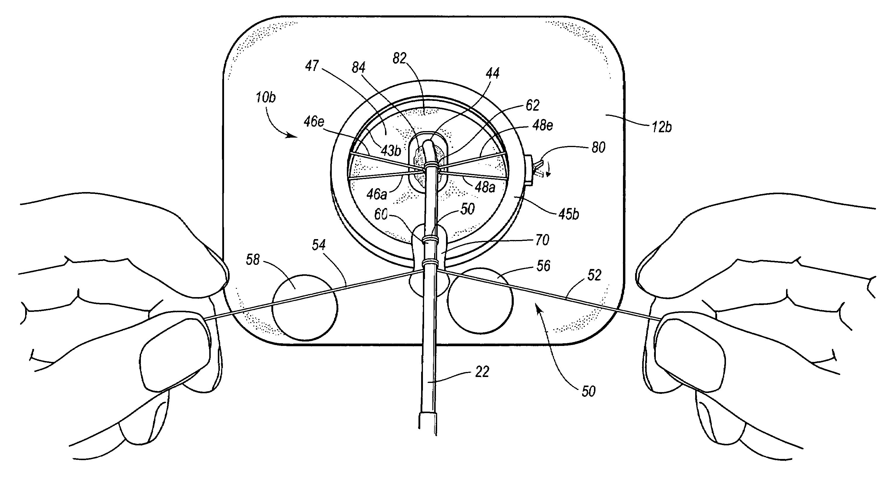 Self-suturing anchor device for a catheter