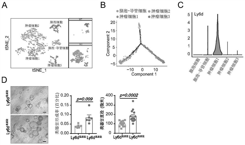 Application of Ly6d in diagnosis, prognosis monitoring and treatment of pancreatic ductal adenocarcinoma