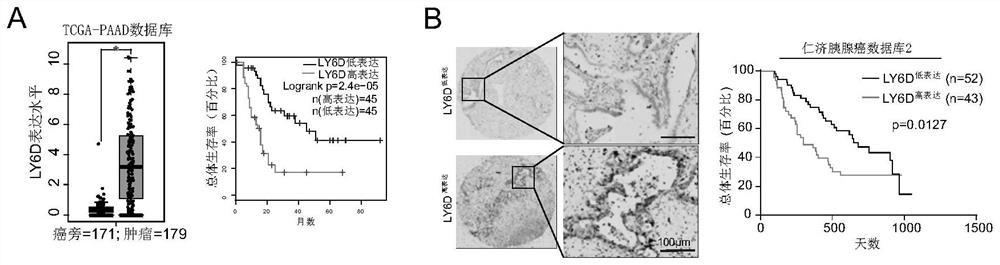 Application of Ly6d in diagnosis, prognosis monitoring and treatment of pancreatic ductal adenocarcinoma