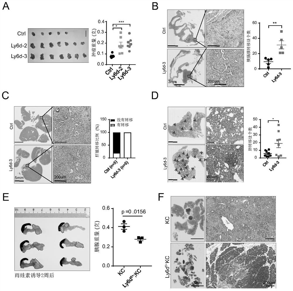 Application of Ly6d in diagnosis, prognosis monitoring and treatment of pancreatic ductal adenocarcinoma