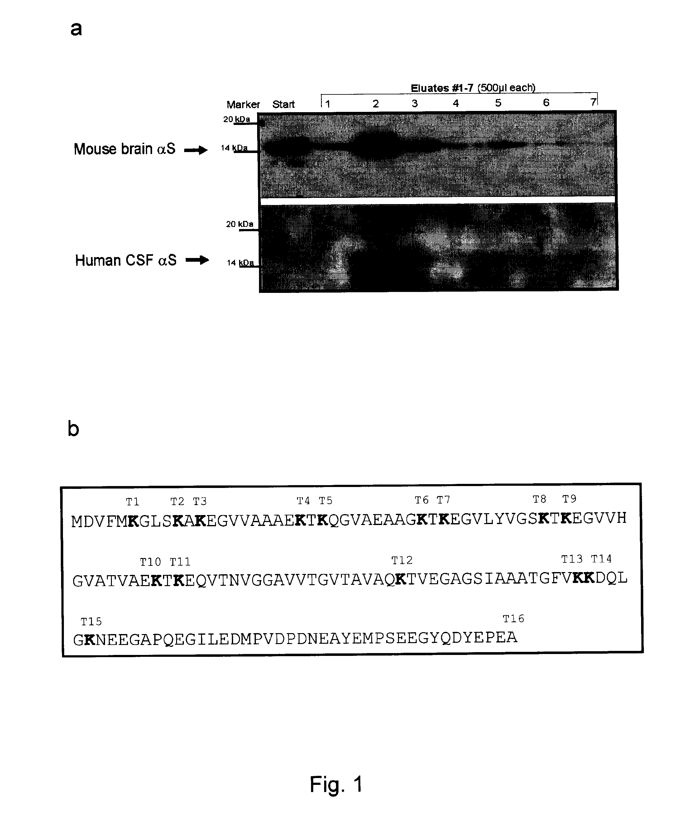 Methods and kits for diagnosing neurodegenerative disease